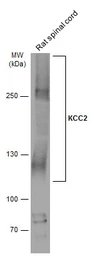 Anti-KCC2 antibody used in Western Blot (WB). GTX133130
